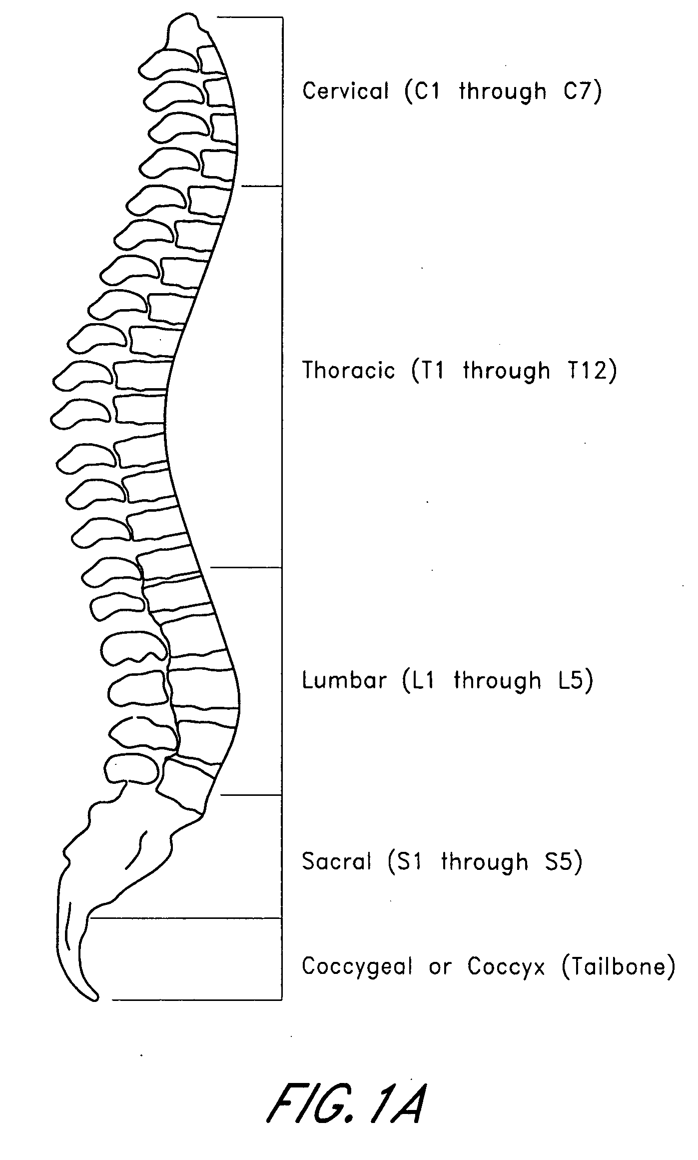 Bone dilator system