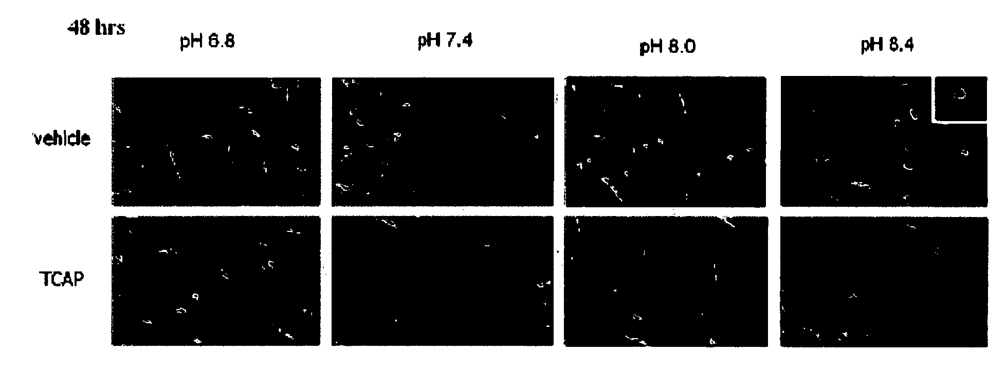 Method for inhibiting neuronal cell death