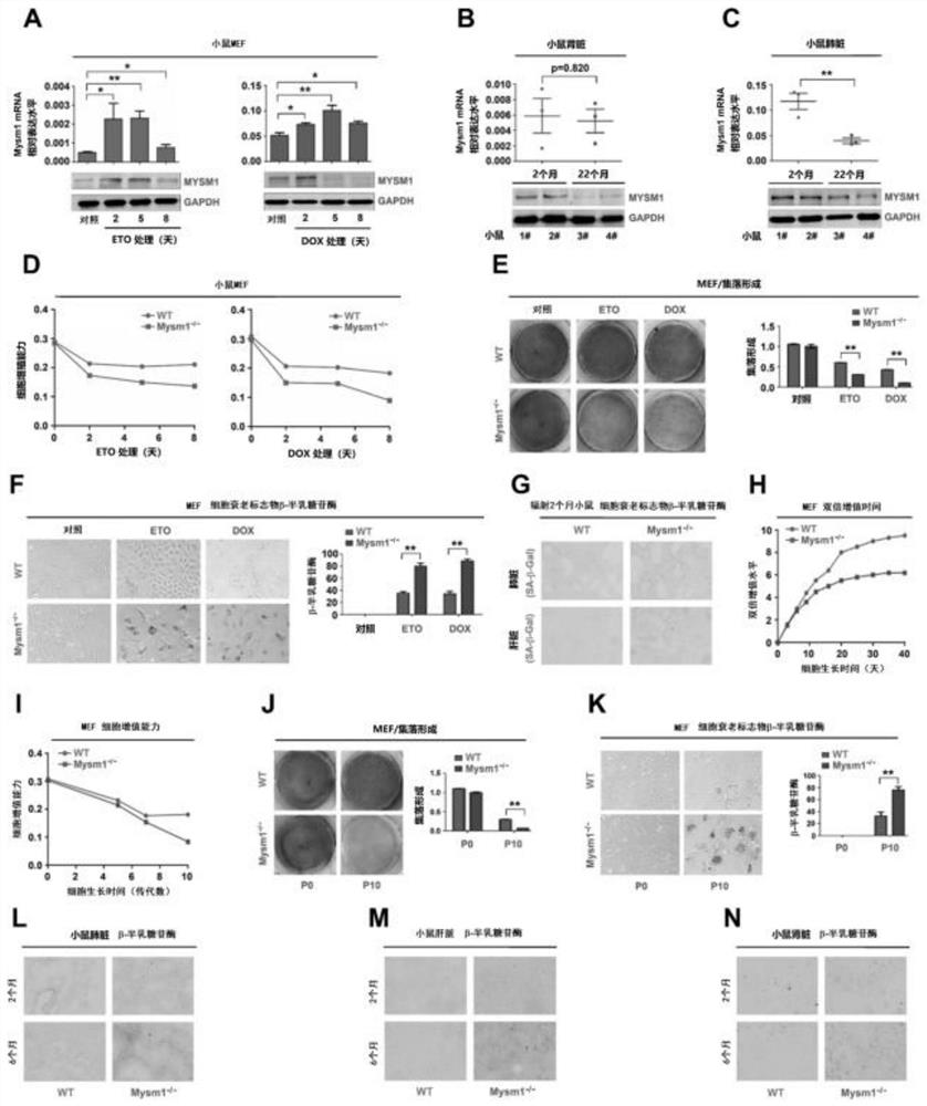 Application of histone deubiquitinase in preparation of medicines for resisting aging and treating aging-related diseases