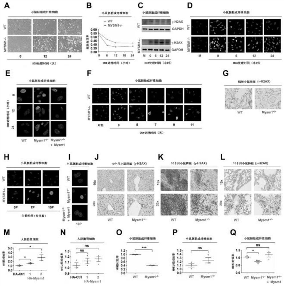 Application of histone deubiquitinase in preparation of medicines for resisting aging and treating aging-related diseases