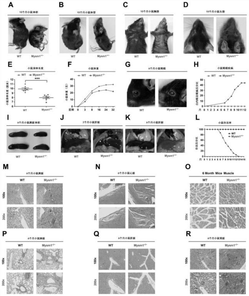 Application of histone deubiquitinase in preparation of medicines for resisting aging and treating aging-related diseases