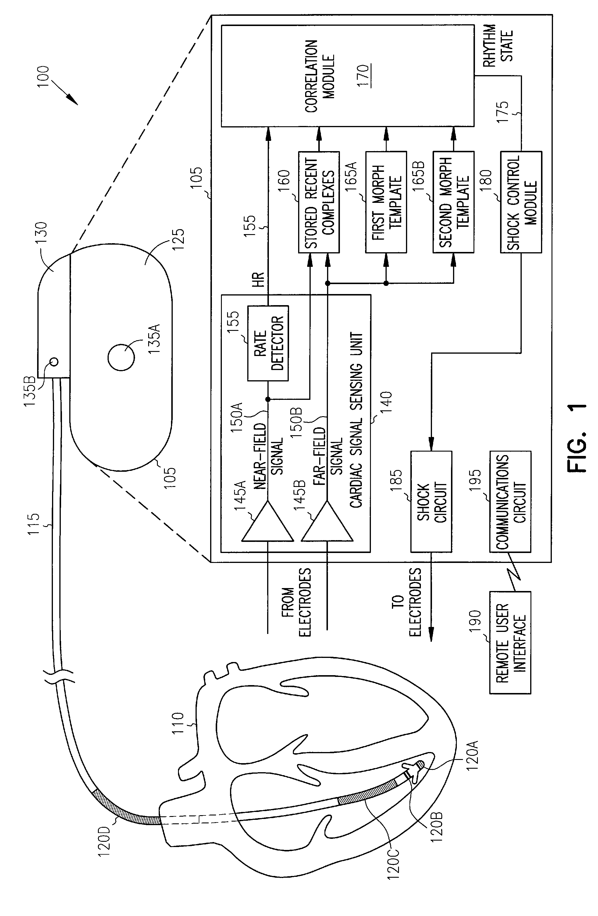 Cardiac rhythm management systems and methods using multiple morphology templates for discriminating between rhythms