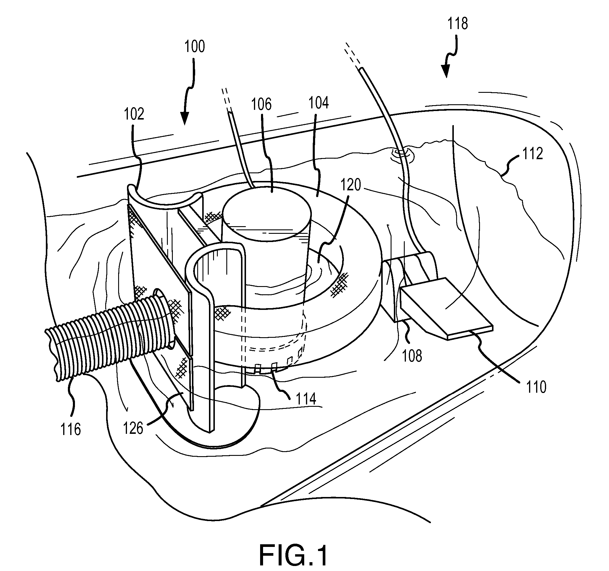 Water pollution prevention and remediation method