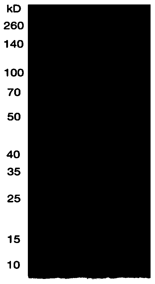 Value setting method for C reactive proteins in serum