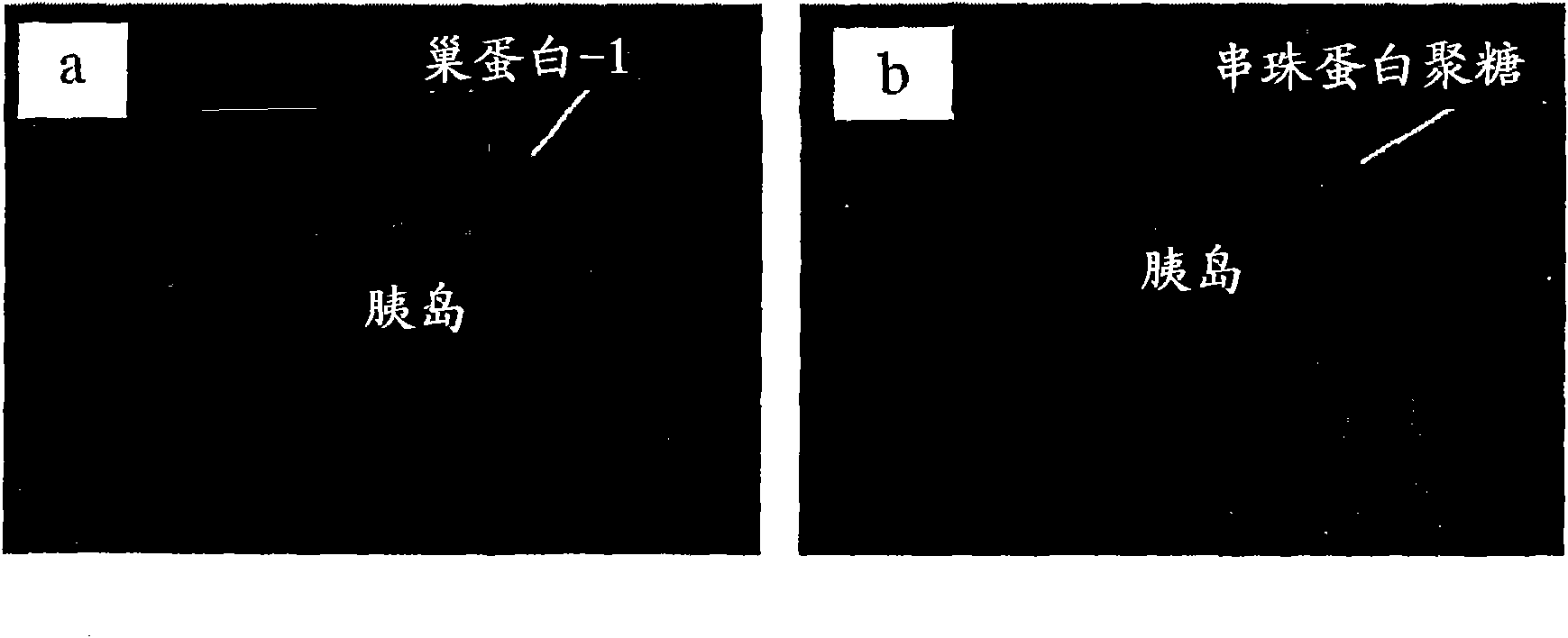 Inhibition of degradation of extracellular matrix