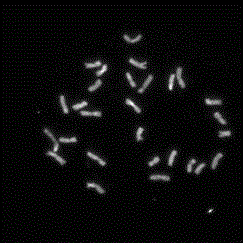 A kind of Chromosome preparation method of the root tip of a plant of the genus Lyme