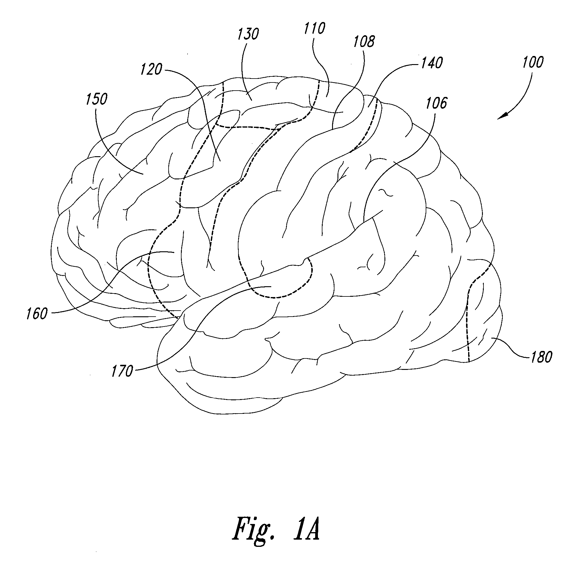 Electrode configurations for reducing invasiveness and/or enhancing neural stimulation efficacy, and associated methods