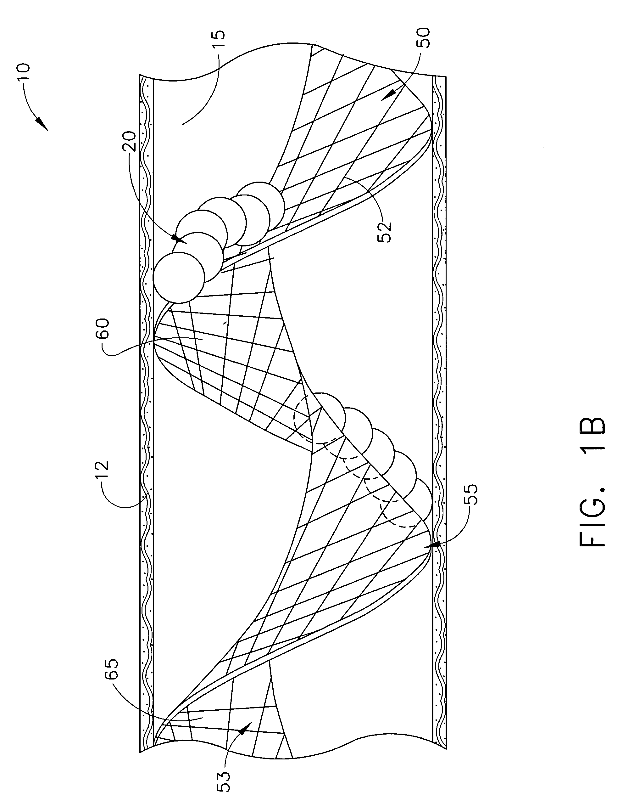 Device for filtering blood in a vessel with helical elements