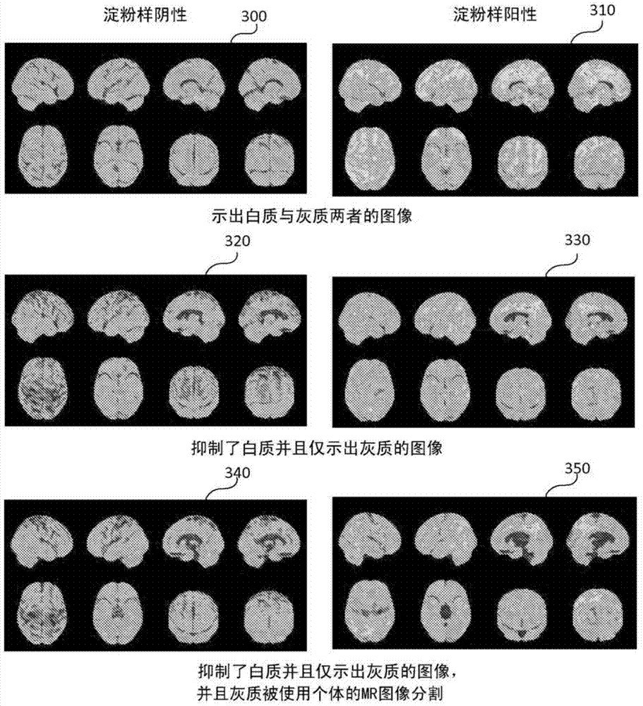 Method to compute and present brain amyloid in gray matter