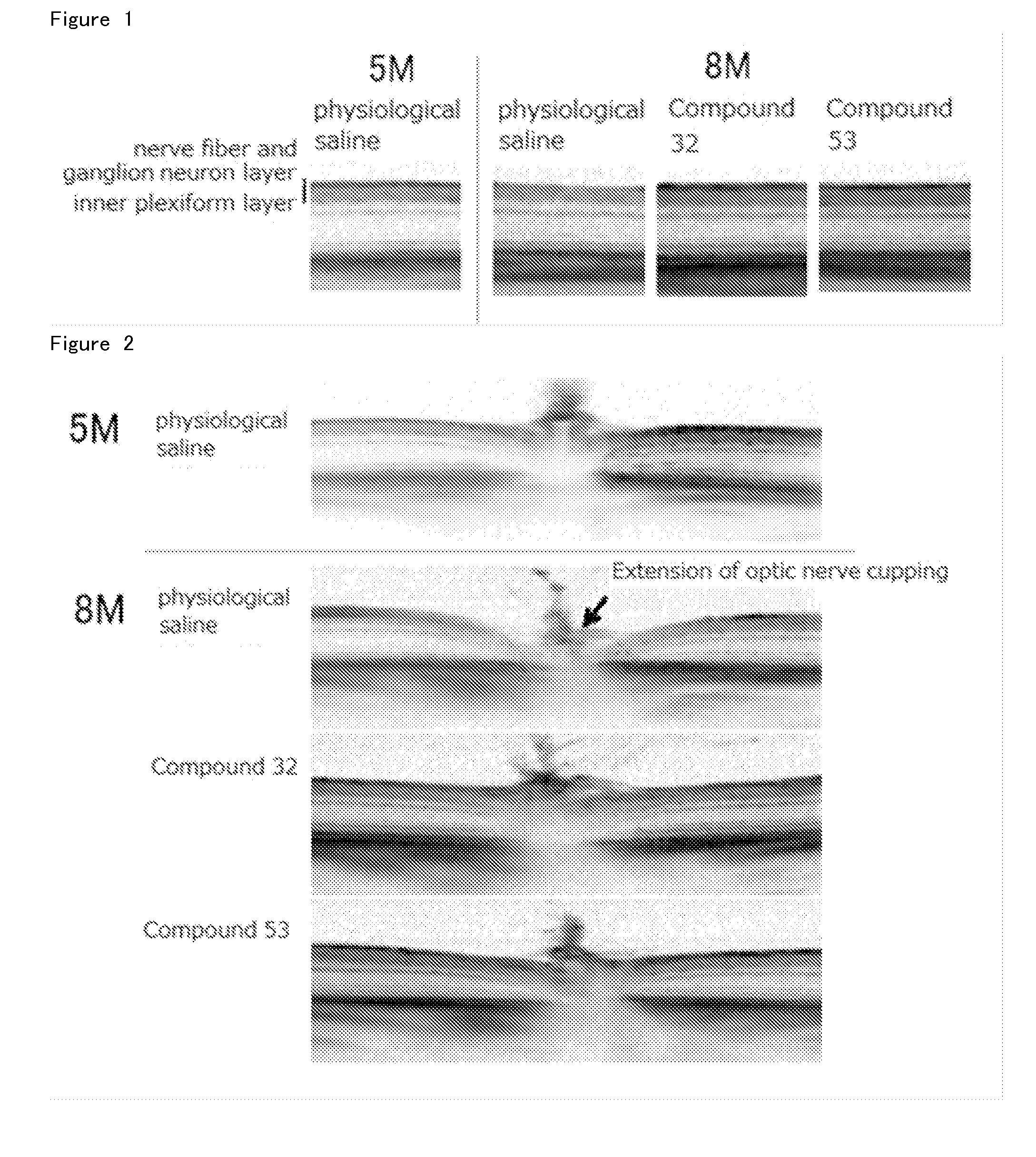 Agent for Treatment of Eye Diseases