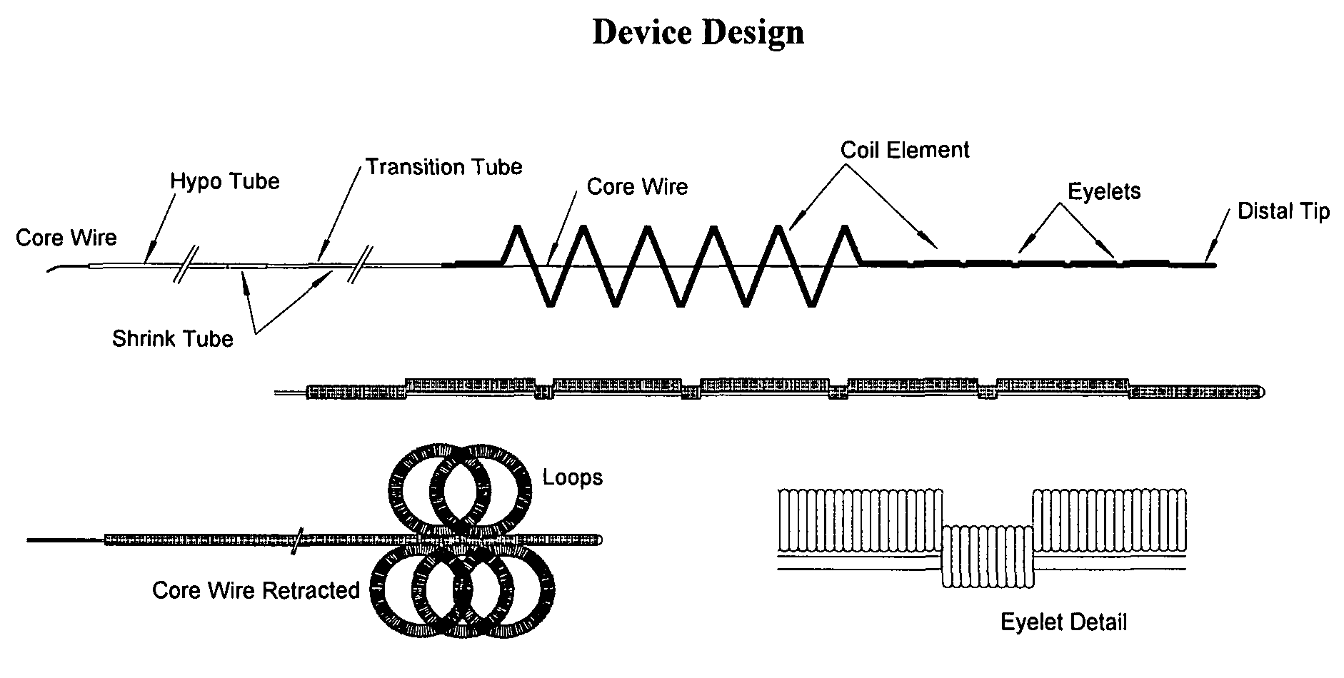 Thrombus removal system and process