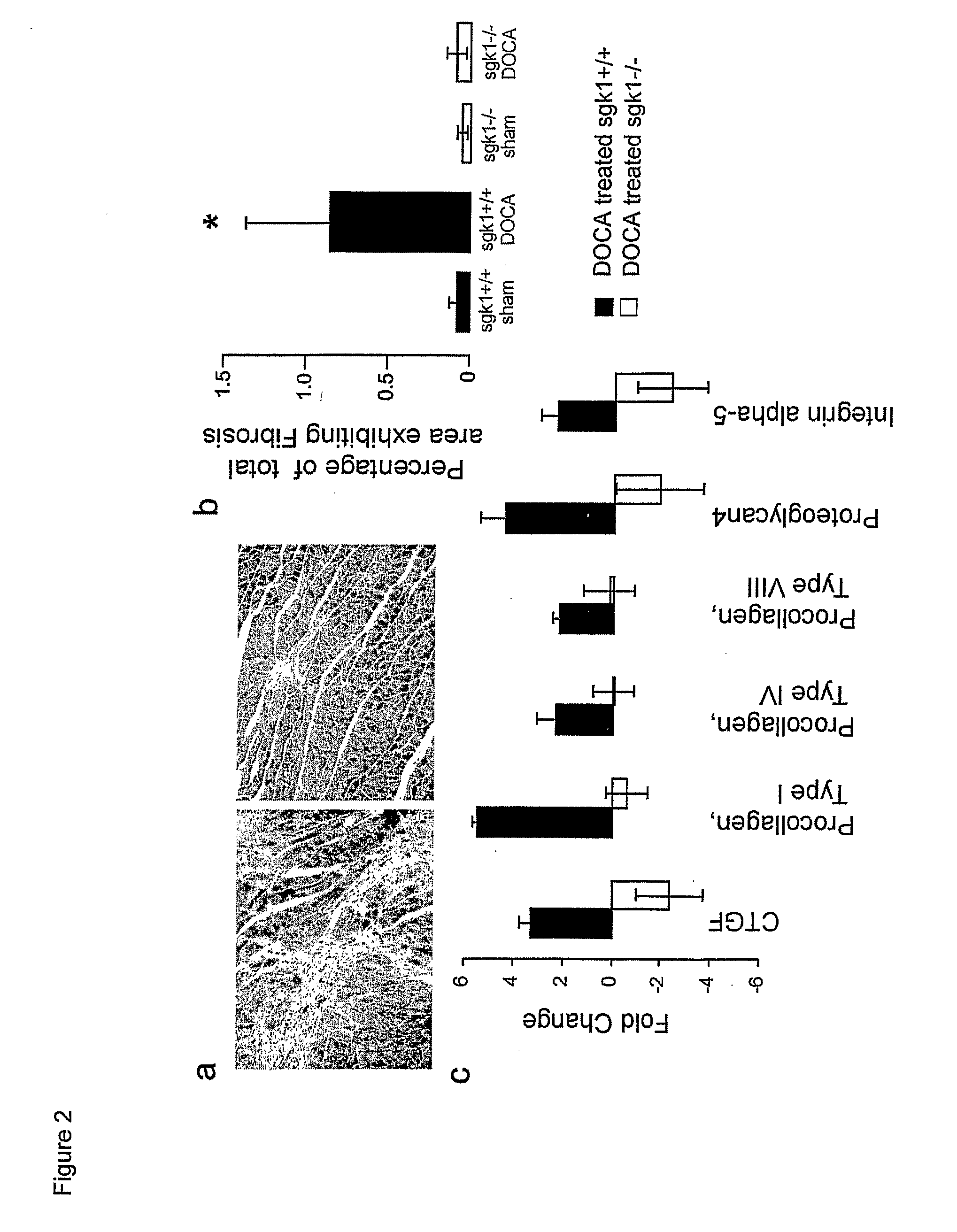 Methods For Interfering With Fibrosis