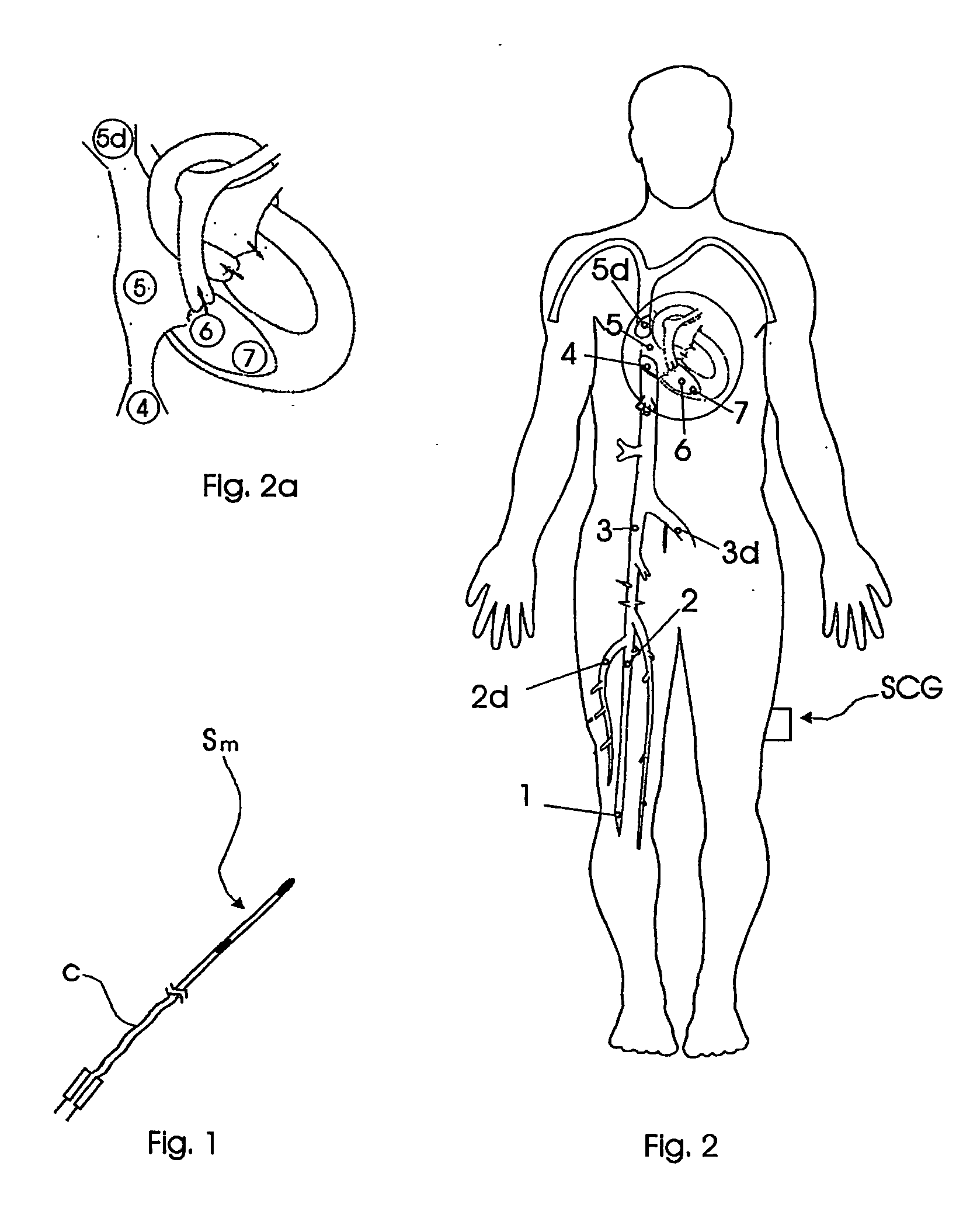 Catheterization method and system