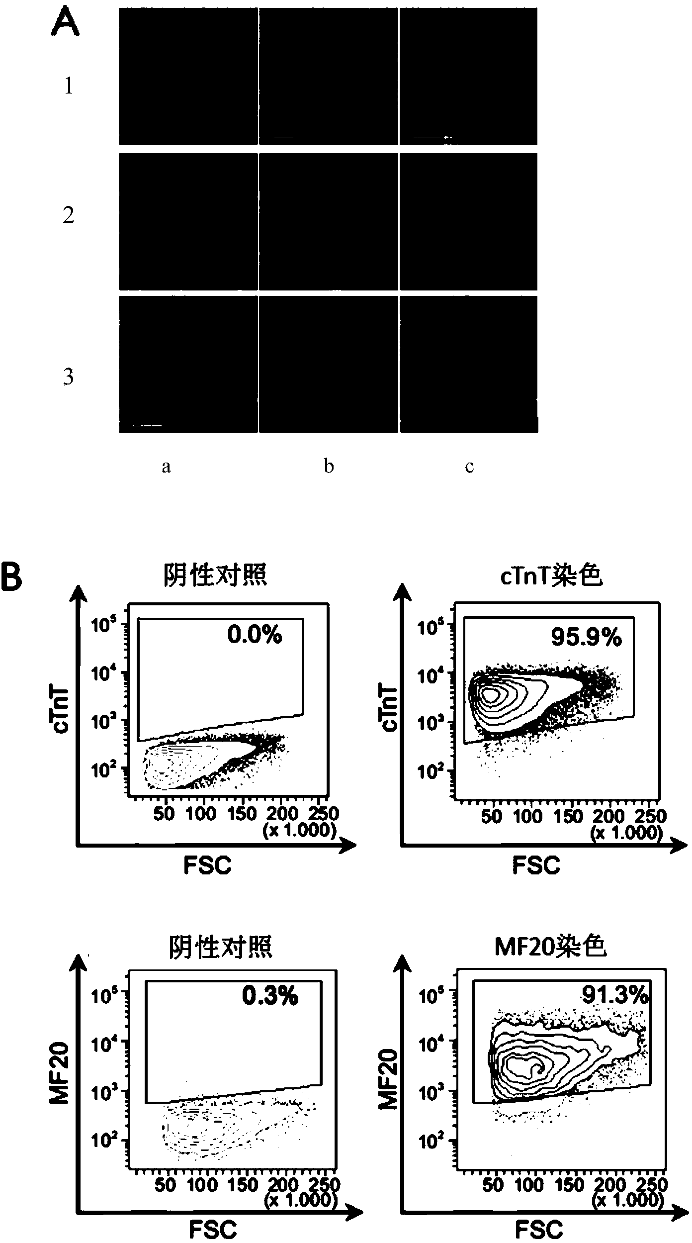 Group of novel molecular markers of one group of human myocardial cells, and applications of novel molecular markers