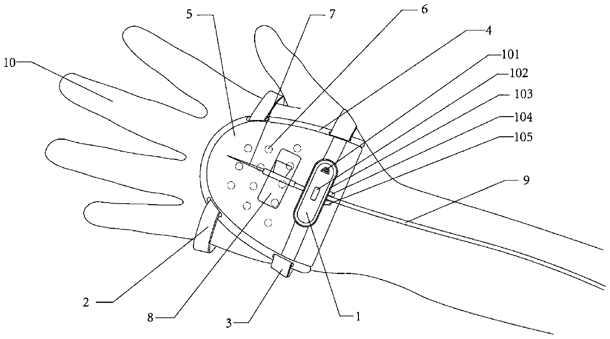 Protective cover for child palmar vein transfusion exosmosis