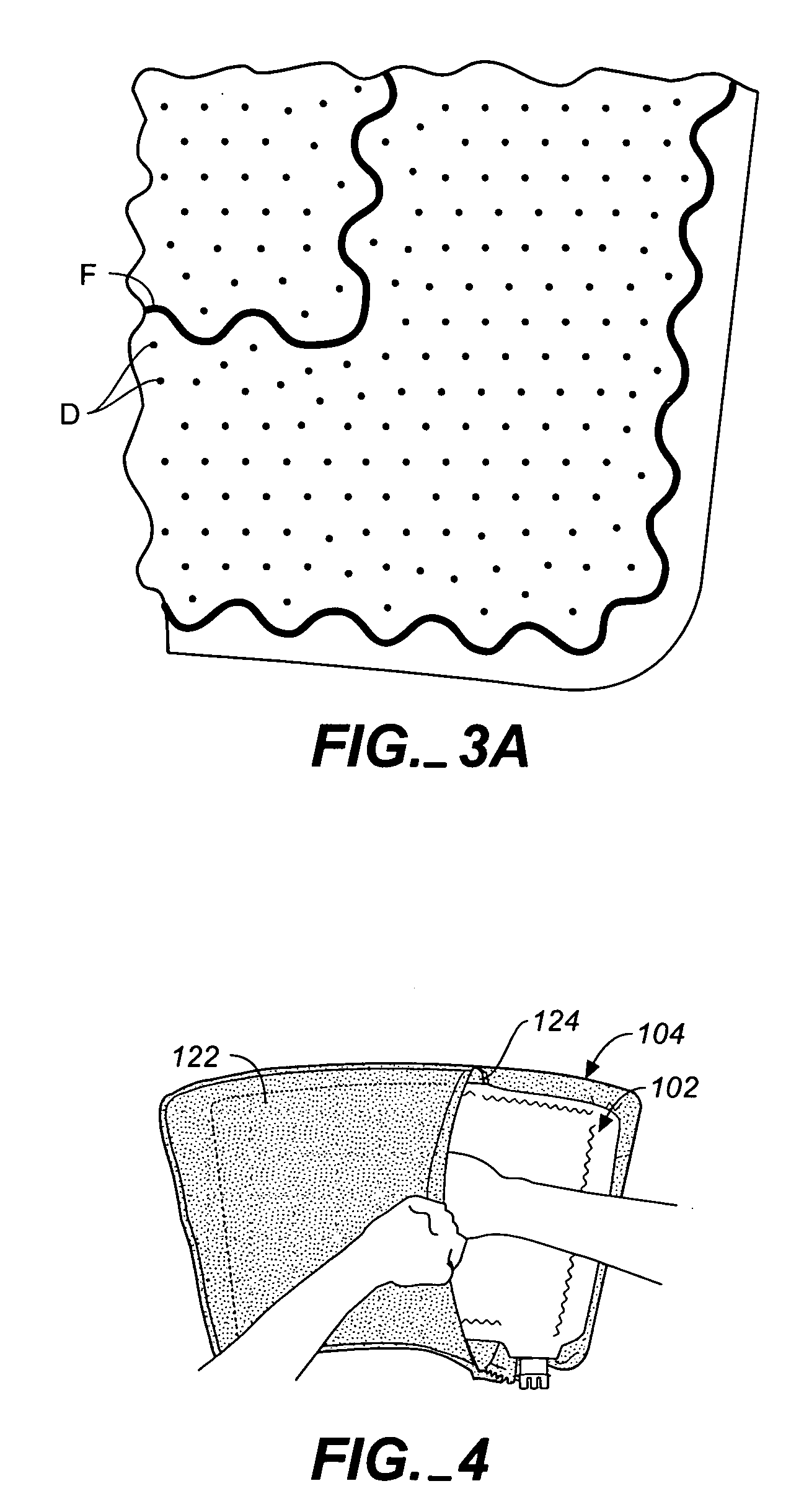 Modular apparatus for therapy of an animate body