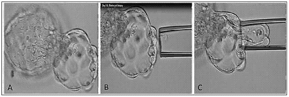 Method for detecting embryo chromosome abnormalities by using blastula-stage embryo cells