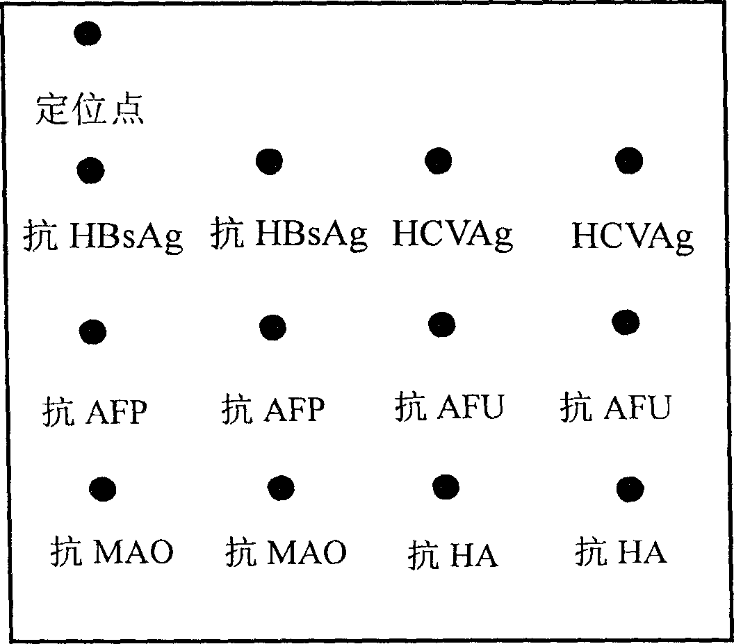 Integral detection reaction plate and protein chip kit of hapetitis and cirrhosis