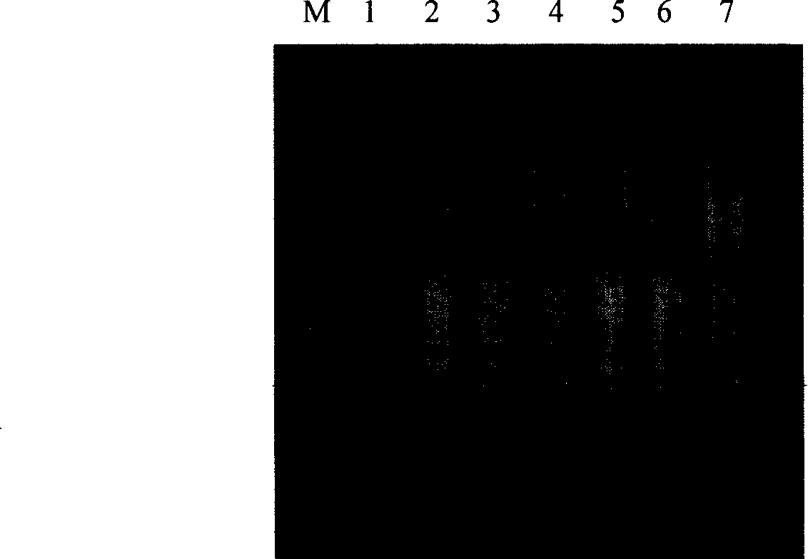 Loop-mediated isothermal amplification detection kit of influenza A3 viruses and detecting method