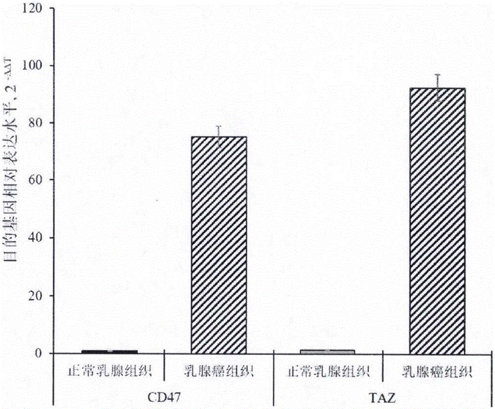 Products and preparation method of double chimeric antigen receptor gene modified T lymphocyte targeting breast cancer stem cells