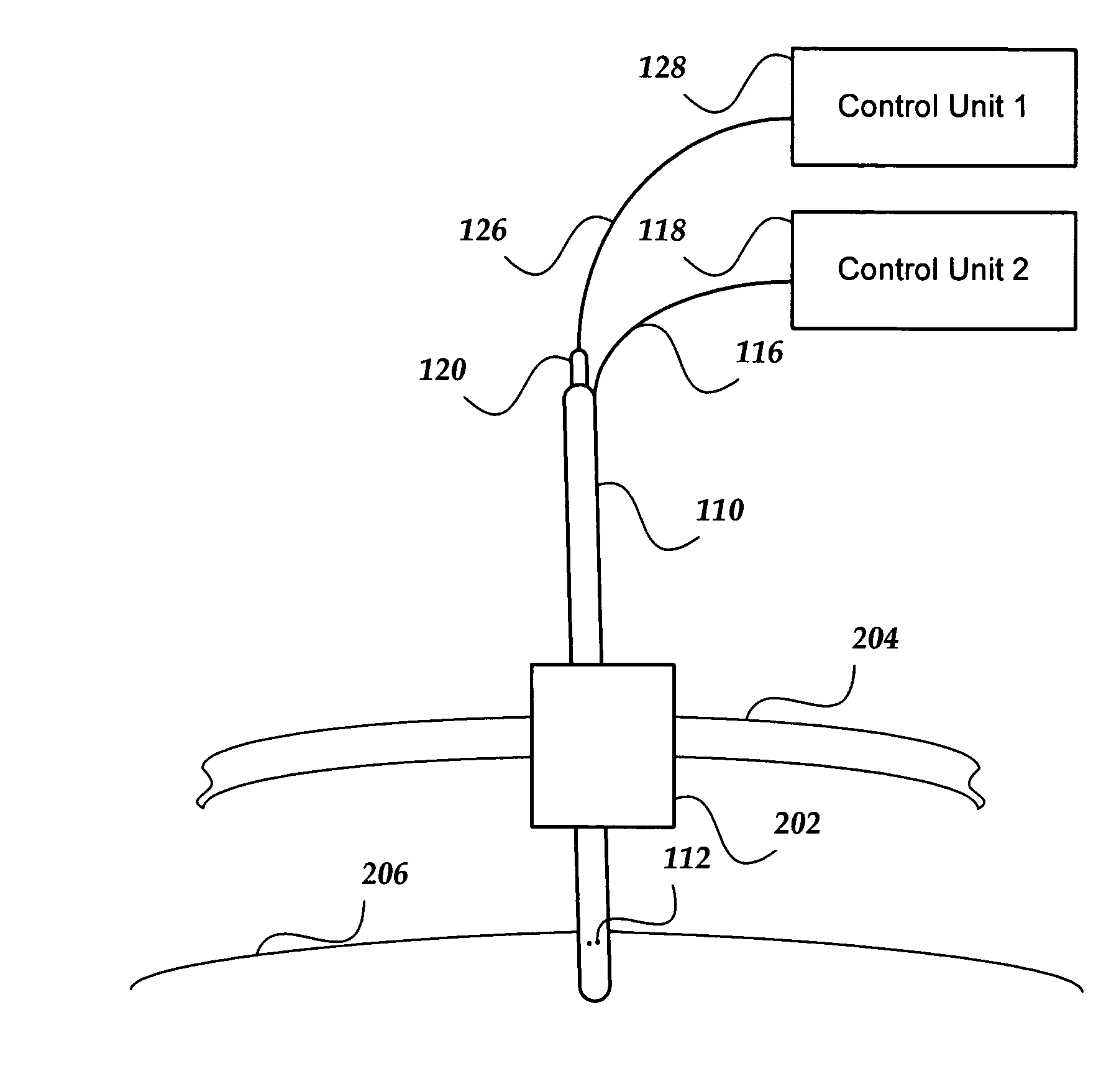 Devices with cannula and electrode lead for brain stimulation and methods of use and manufacture