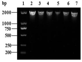 Acetyl CoA synthetase gene RKACS1 and application thereof