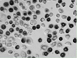 Cornea-like epithelioid cell, tissue-engineered corneal epithelium as well as preparation and application