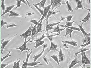 Cornea-like epithelioid cell, tissue-engineered corneal epithelium as well as preparation and application