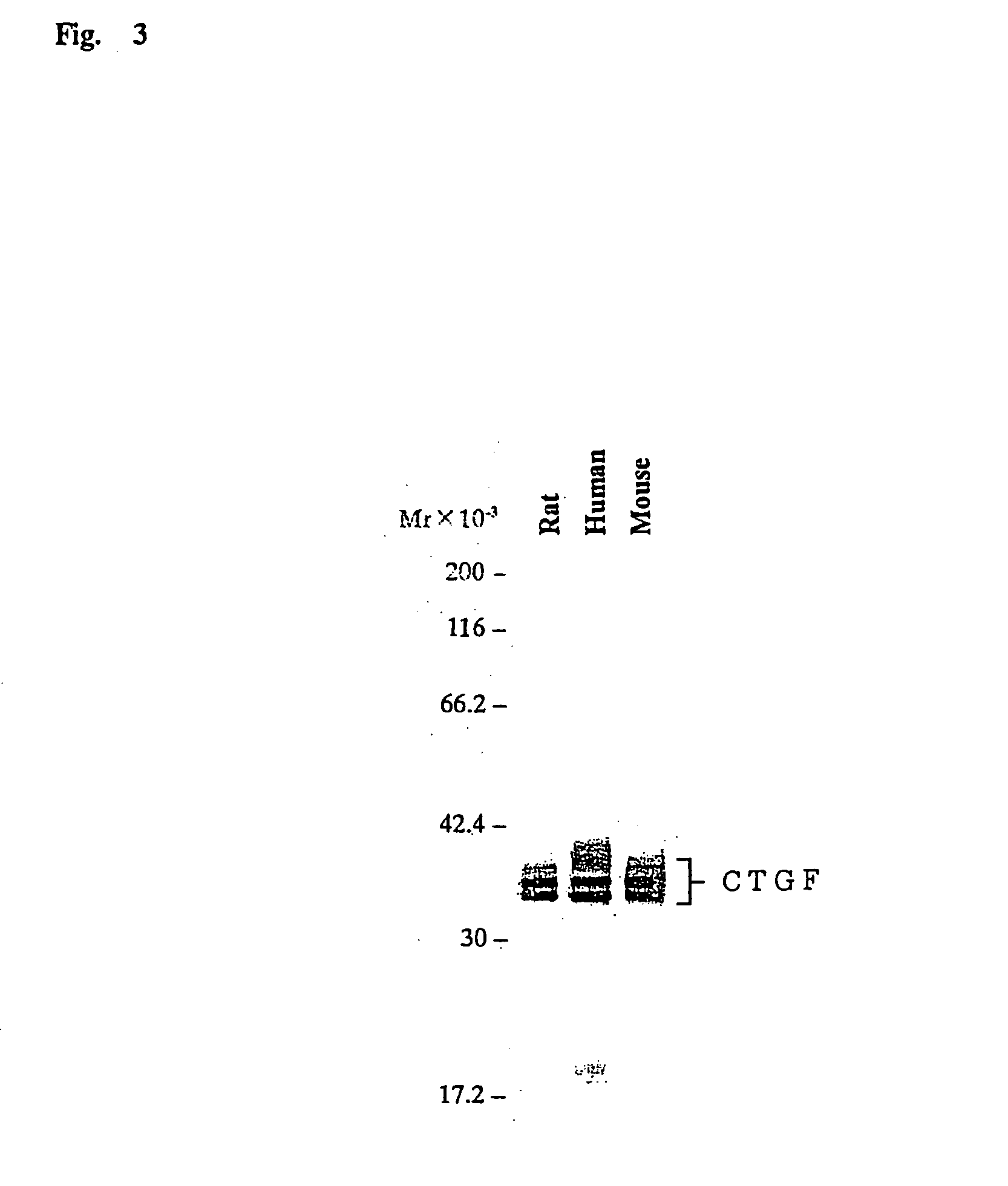 Monoclonal antibody against connective tissue growth factor and medicinal uses thereof