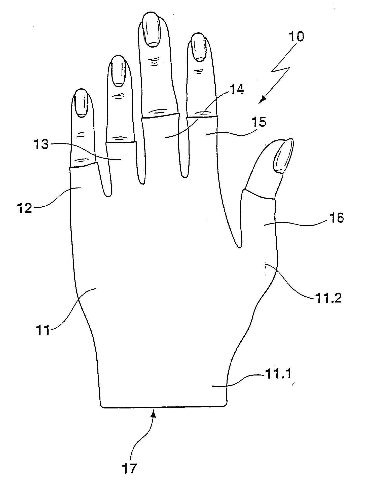 Knitted garment for the support and/or compression and/or compression therapy of parts of the body