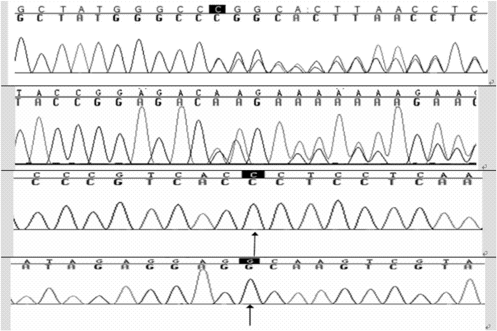 SNaPshot kit for detecting polymorphism of deafness genes of 22 sites