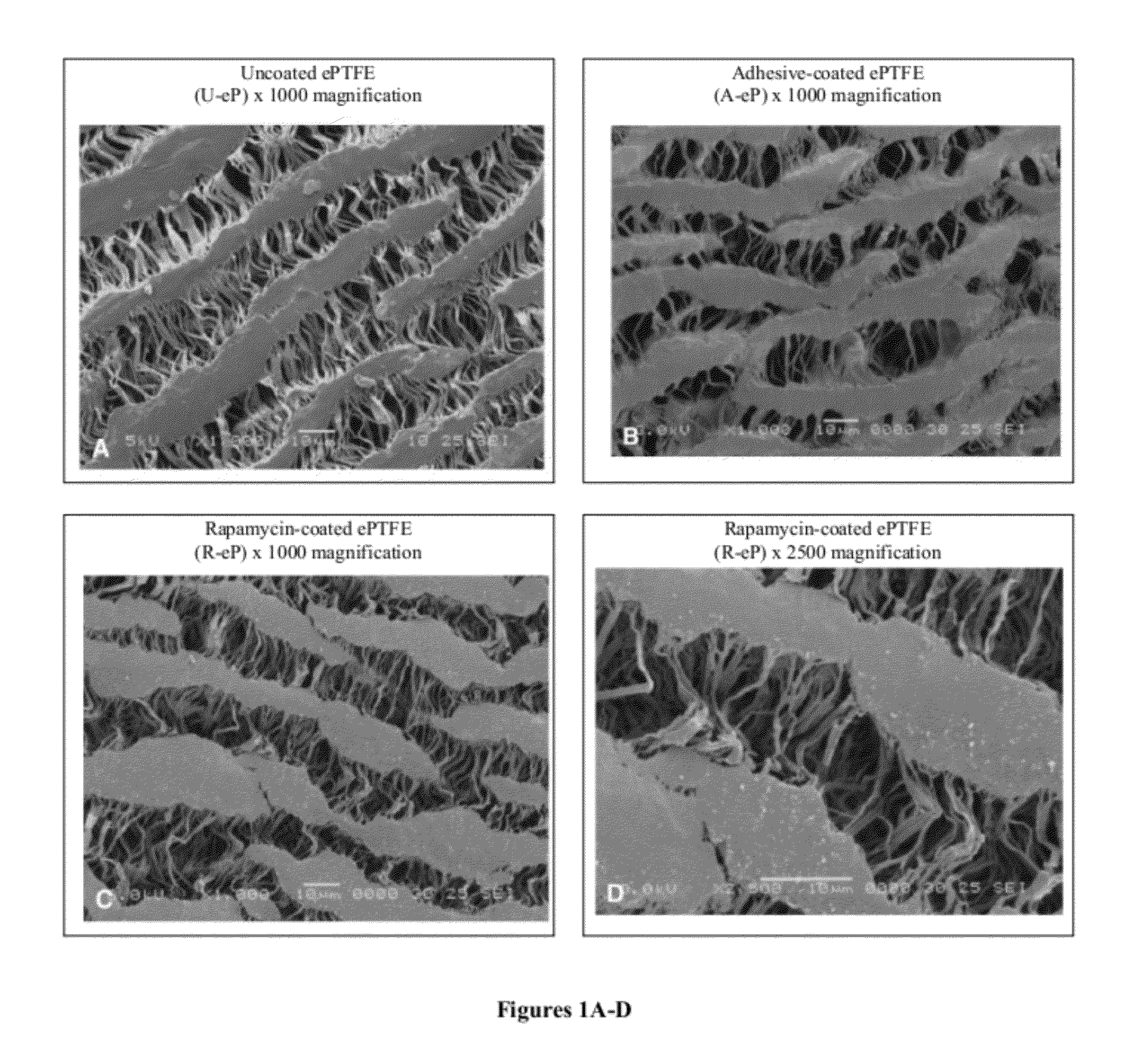 Adhesive composition for carrying therapeutic agents as delivery vehicle on coatings applied to vascular grafts