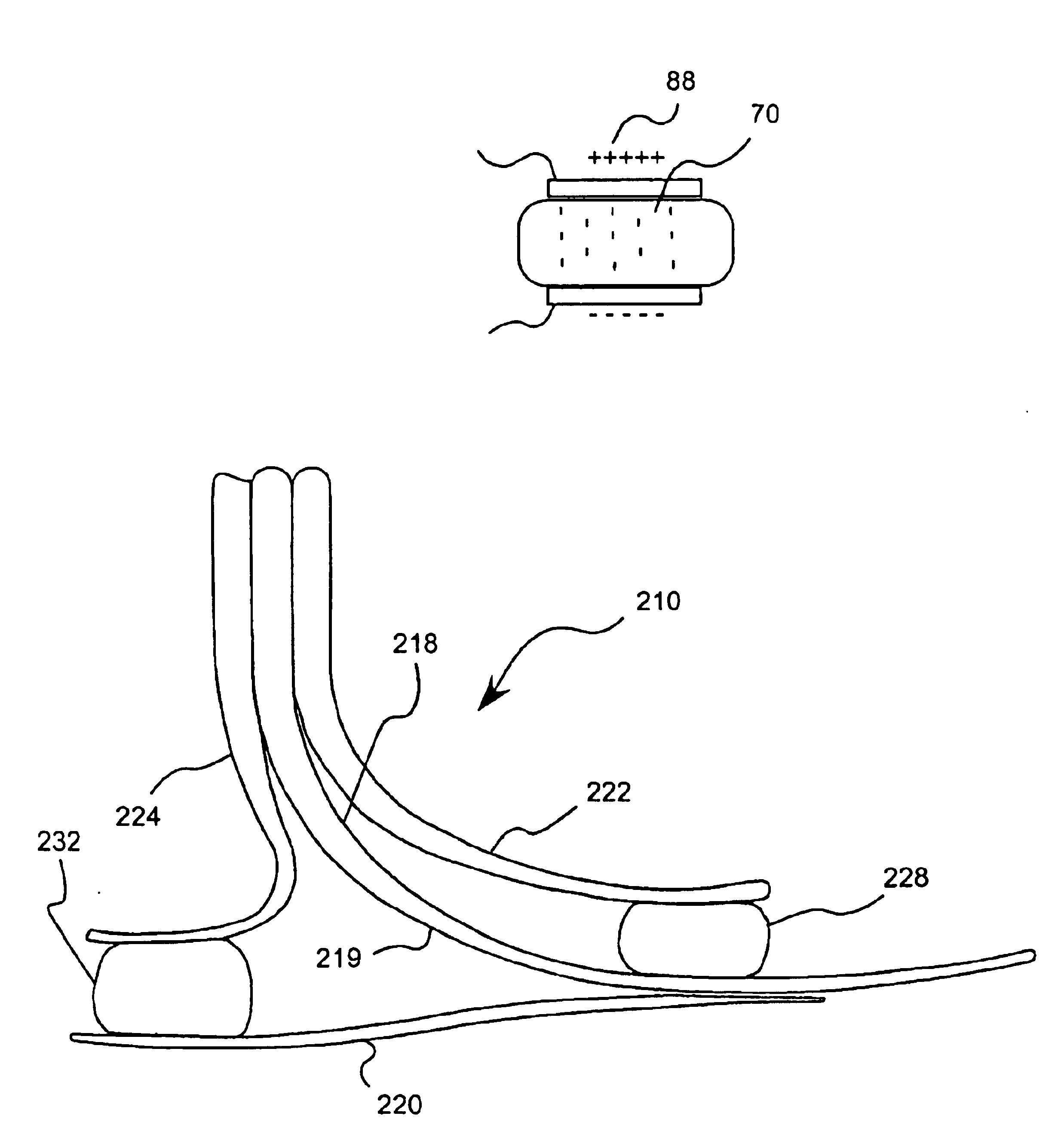 Prosthetic foot with energy transfer medium including variable viscosity fluid