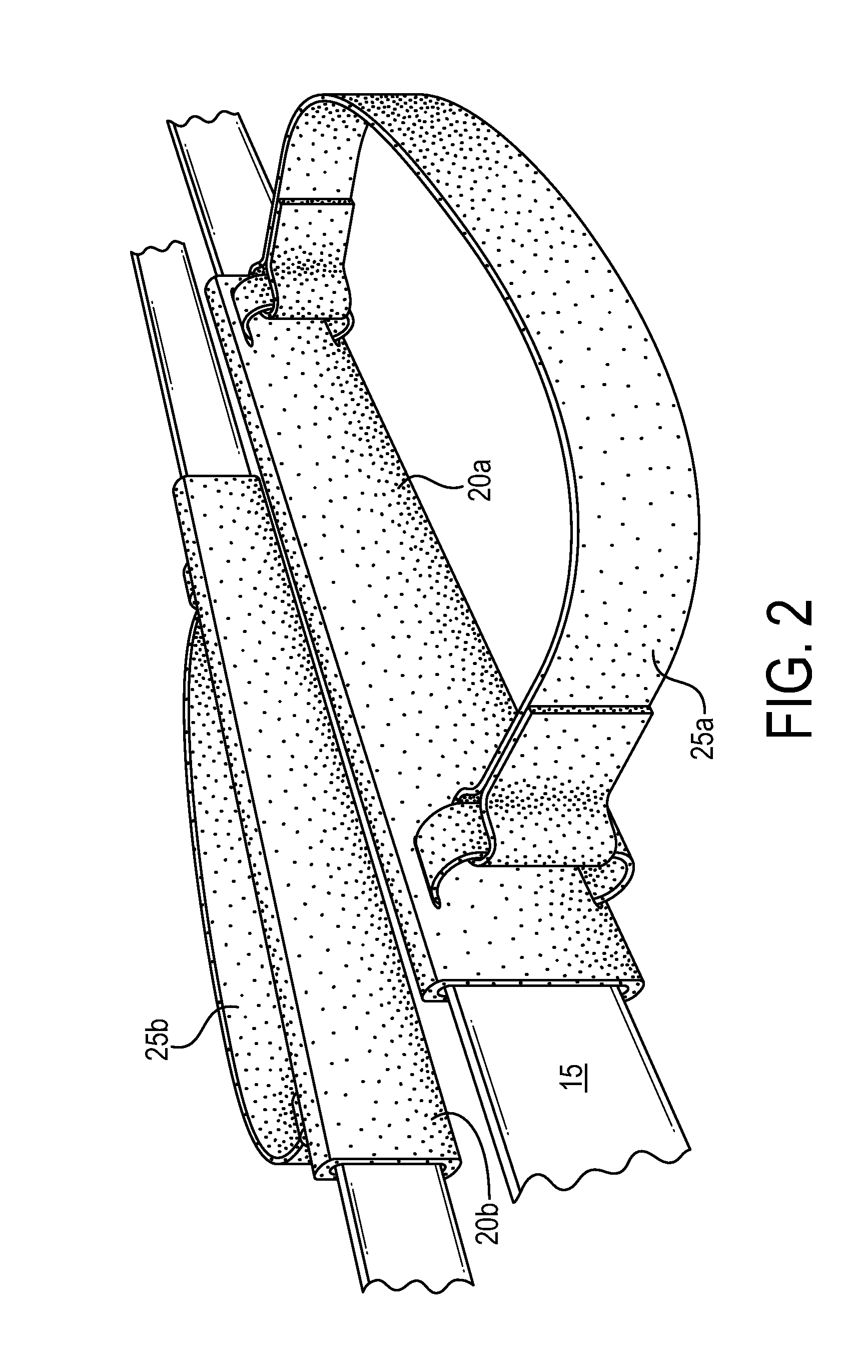 Exercise device including elastic closed loop resistance tension band