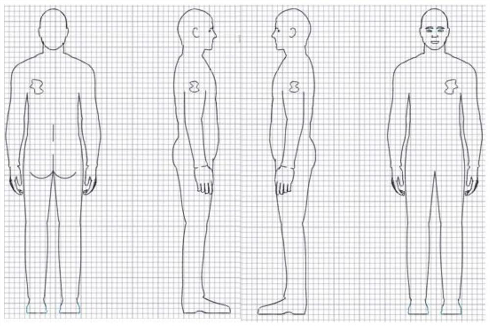 Three-dimensional finite element grid accurate positioning radiotherapy system