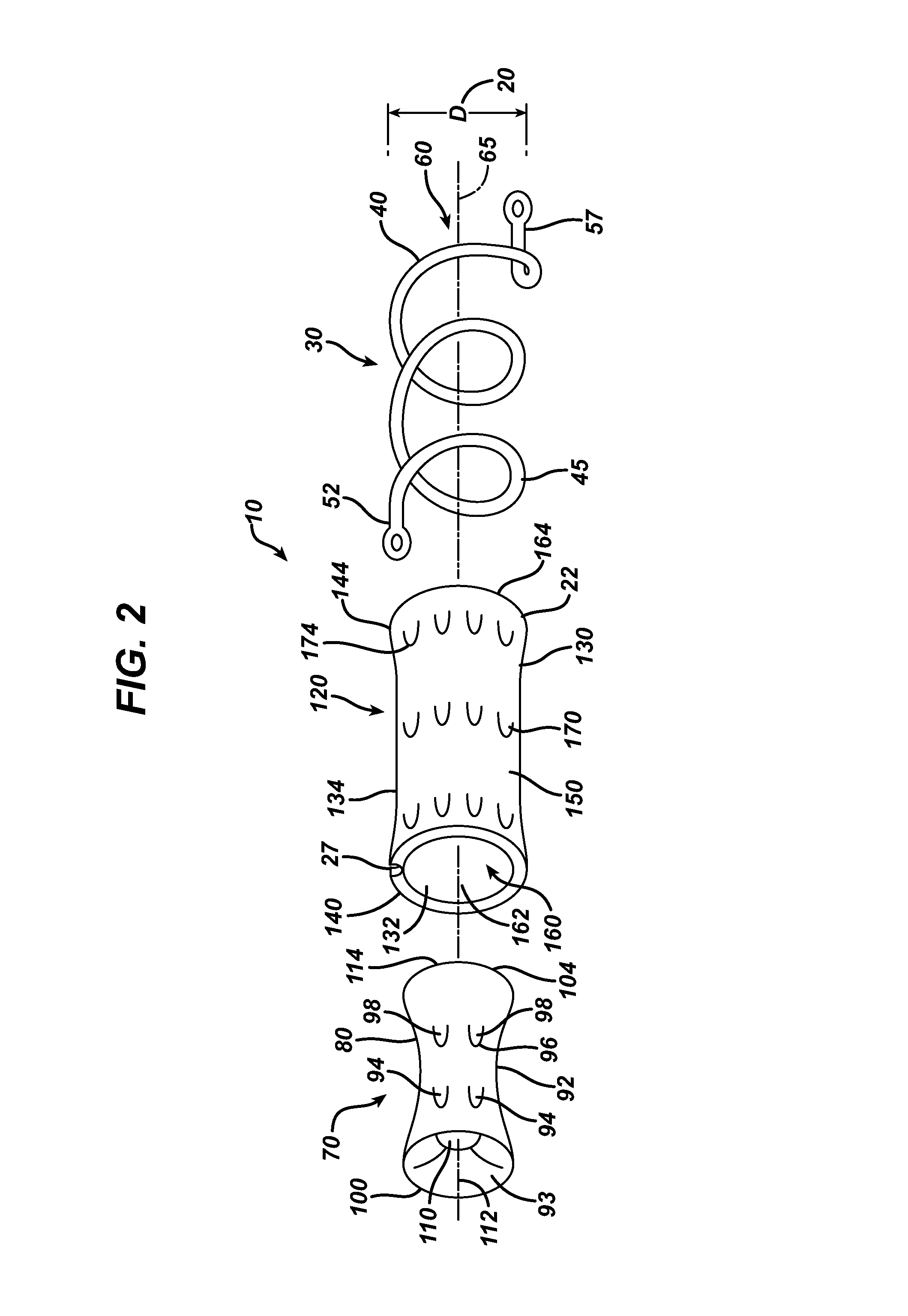 Negative pressure intestinal anastomosis protection devices