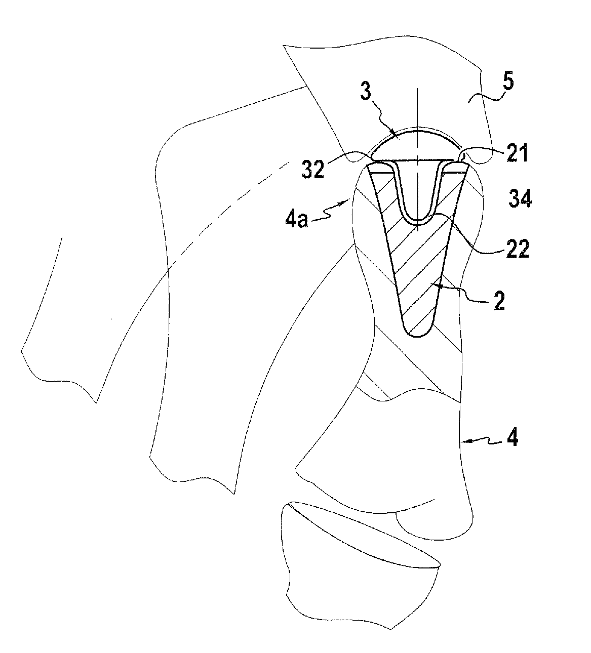 Trapezo-metacarpal implant