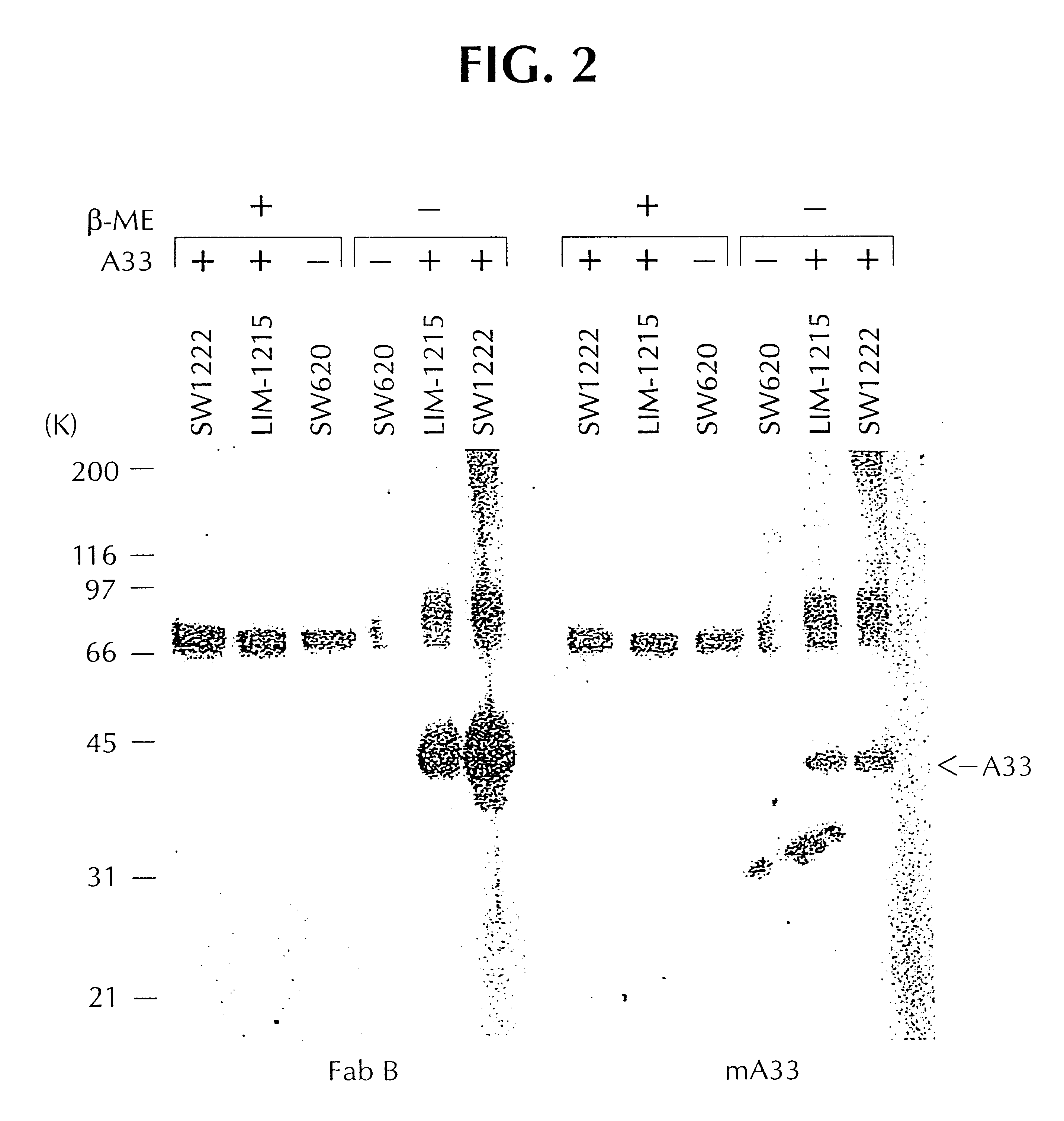 A33 antigen specific immunoglobulin products and uses thereof