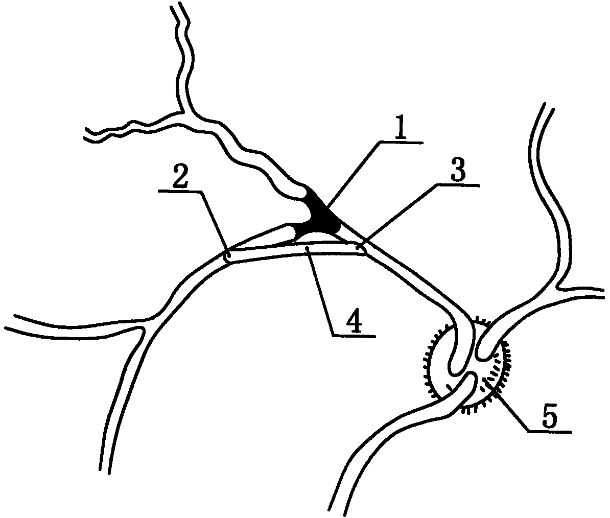 Method for preparing live animal eye model by retinal vein artificial blood vessel bypass operation