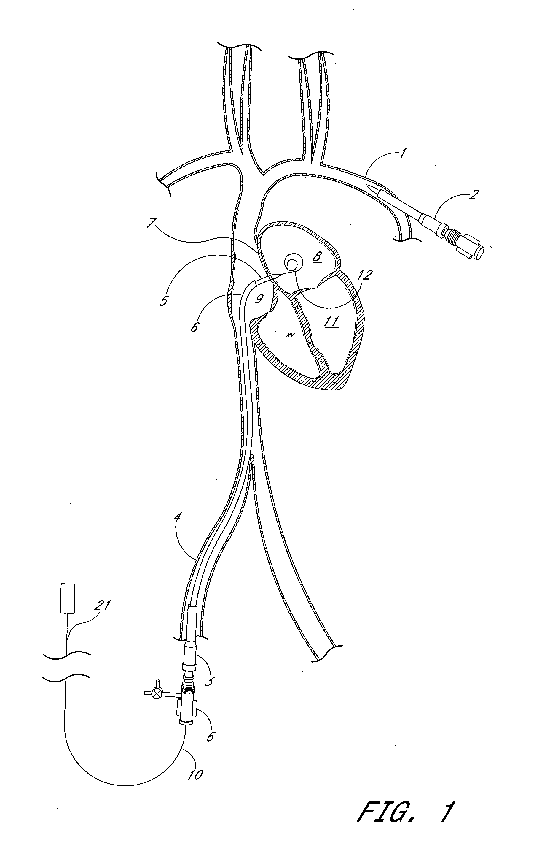 System and method for manipulating insertion pathways for accessing target sites