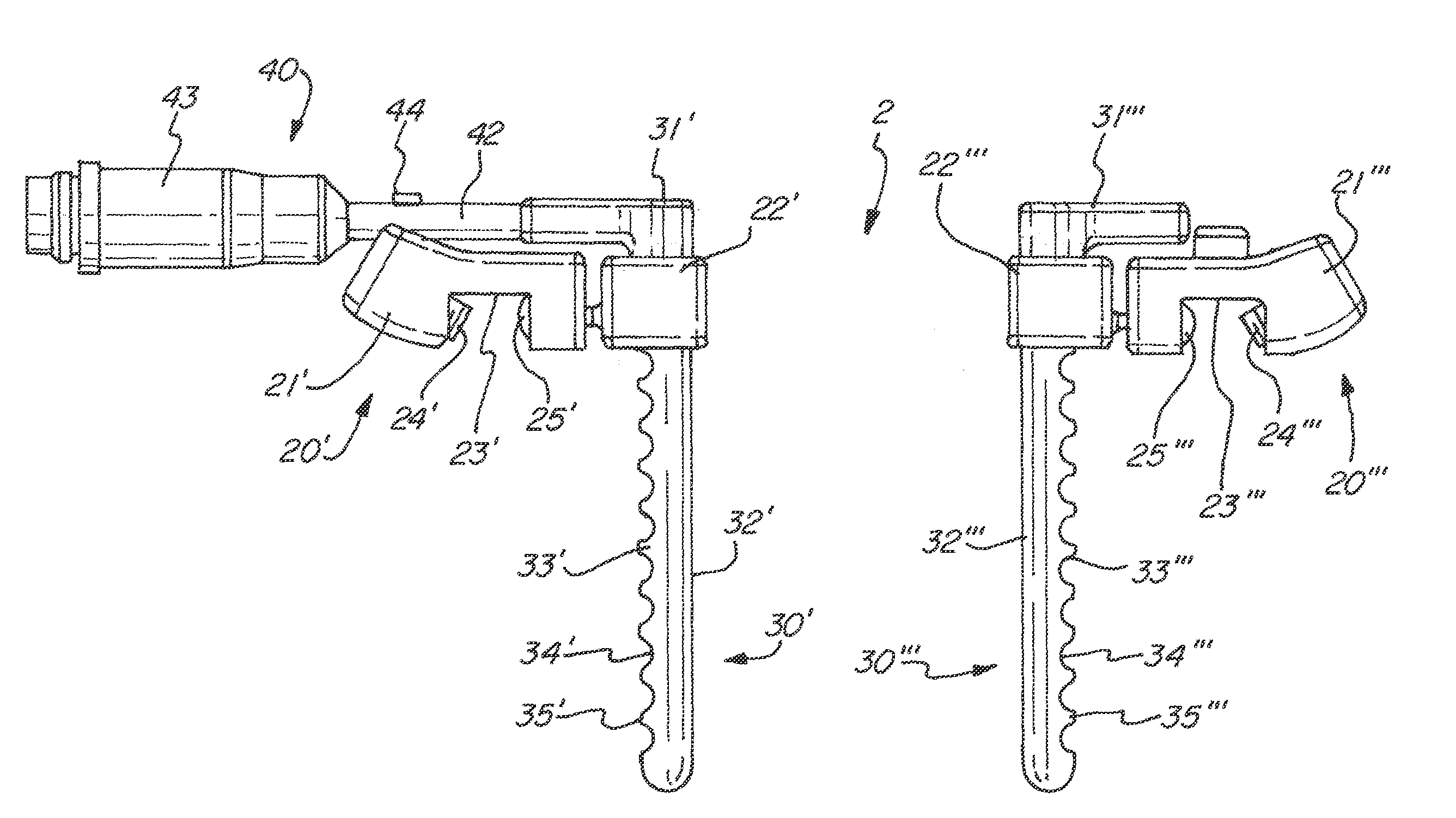 Thoracic retractor