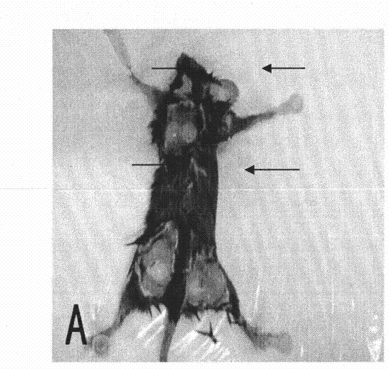 Method for establishing mouse transplanting tumor model with normal immunologic function