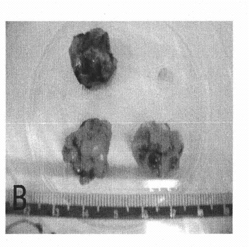 Method for establishing mouse transplanting tumor model with normal immunologic function