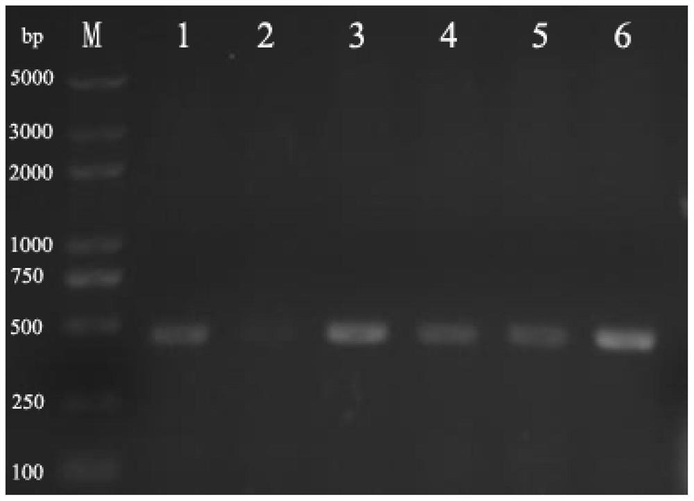 A method for preparing 10-hydroxy-2-decenoic acid using resting cells of Escherichia coli engineering bacteria