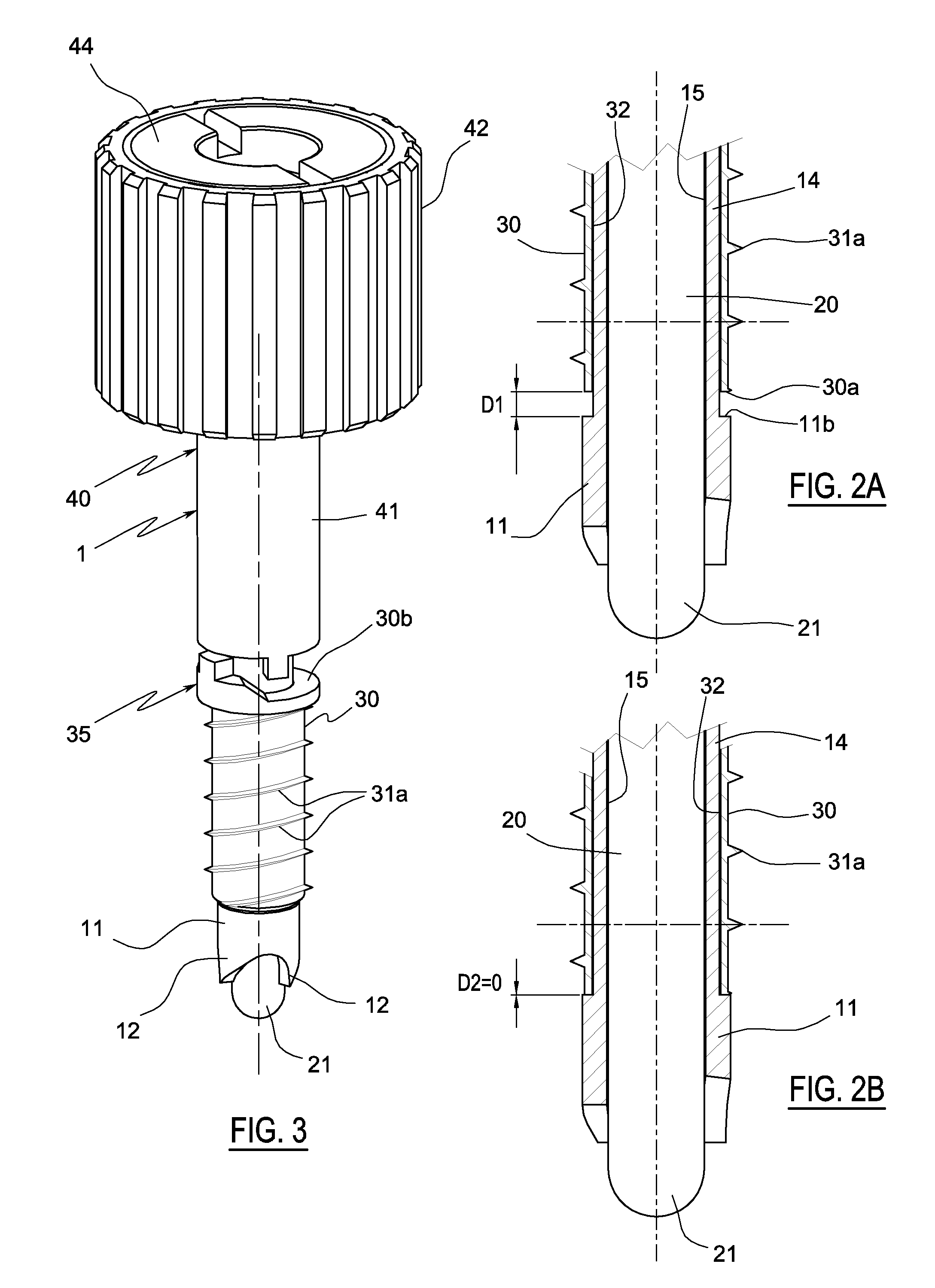 Surgical bone milling instrument