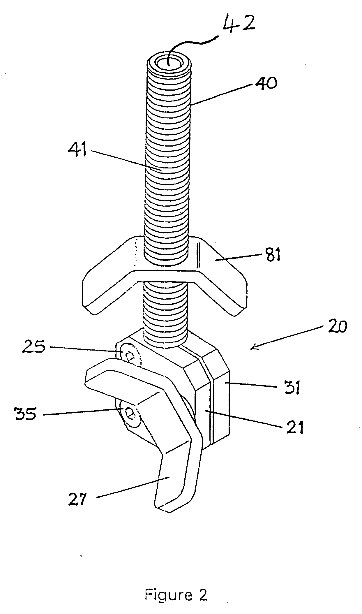 Safety line anchor