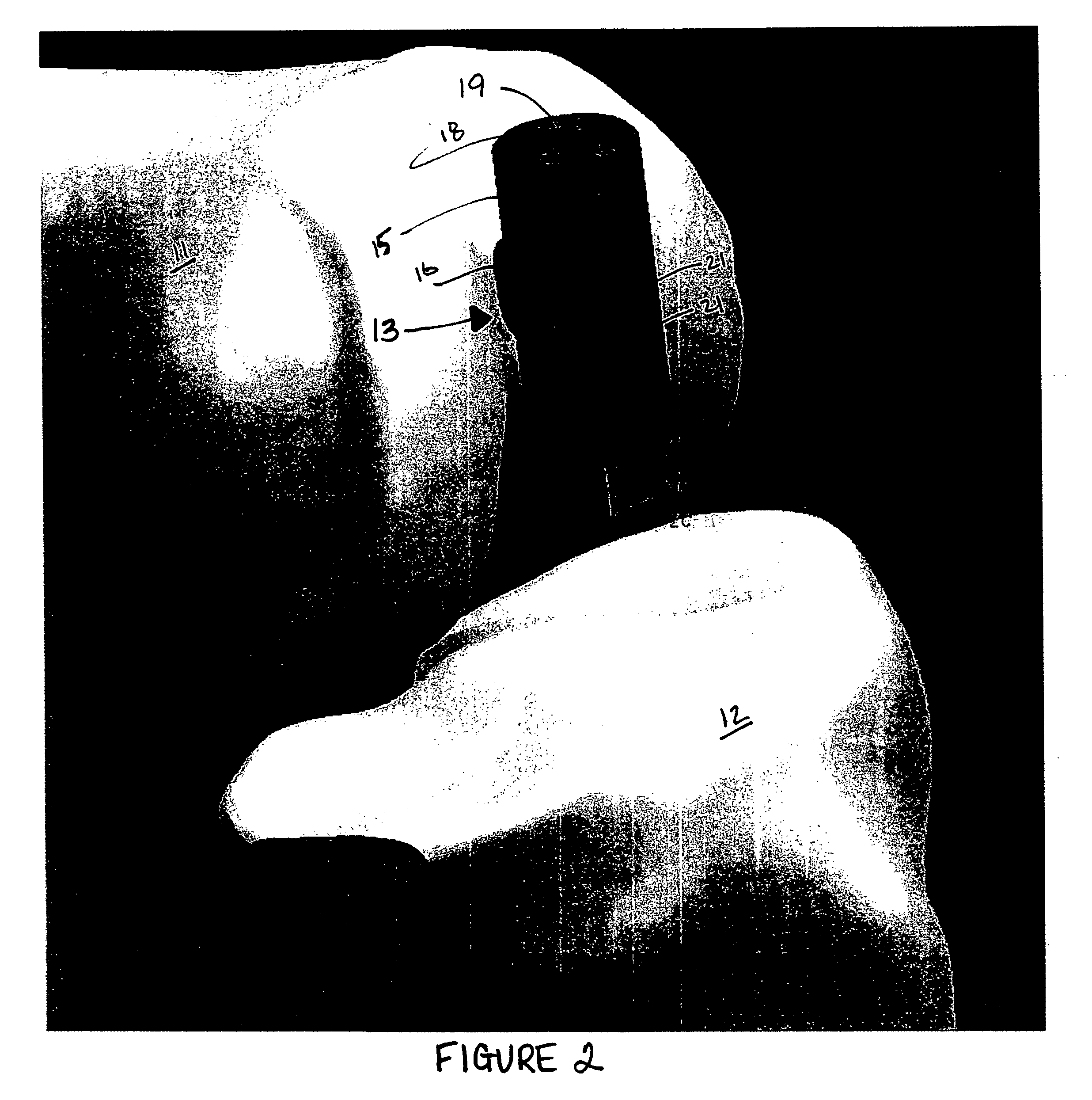 Guide assembly for guiding cuts to a femur and tibia during a knee arthroplasty