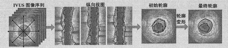 Three-dimensional segmentation method for intravascular ultrasound image sequence