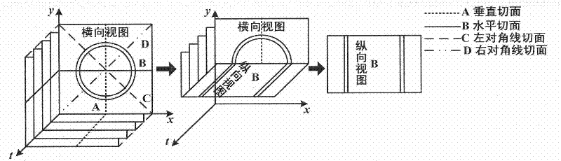 Three-dimensional segmentation method for intravascular ultrasound image sequence