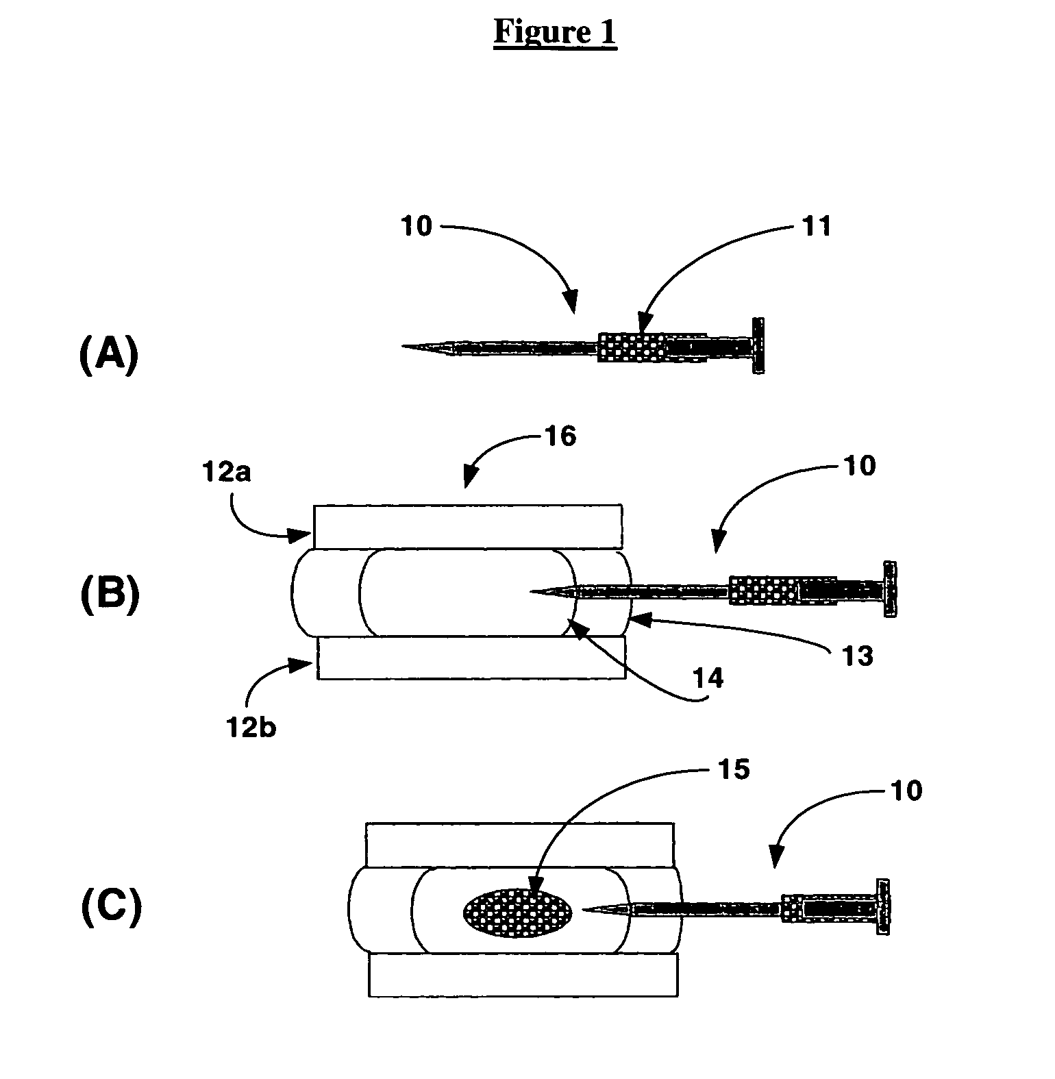 Intervertebral disc augmentation and rehydration with superabsorbent polymers